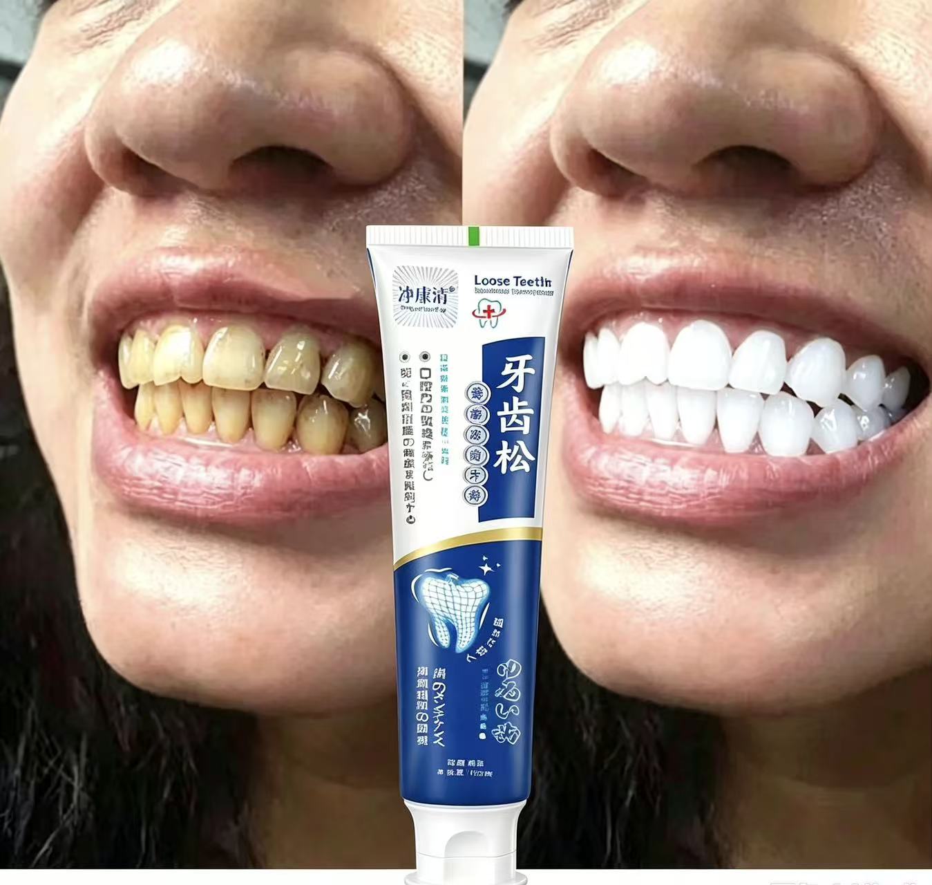 Teeth Whitening Japanese - Japanische Import-Zahnpasta zur Reparatur loser Zähne