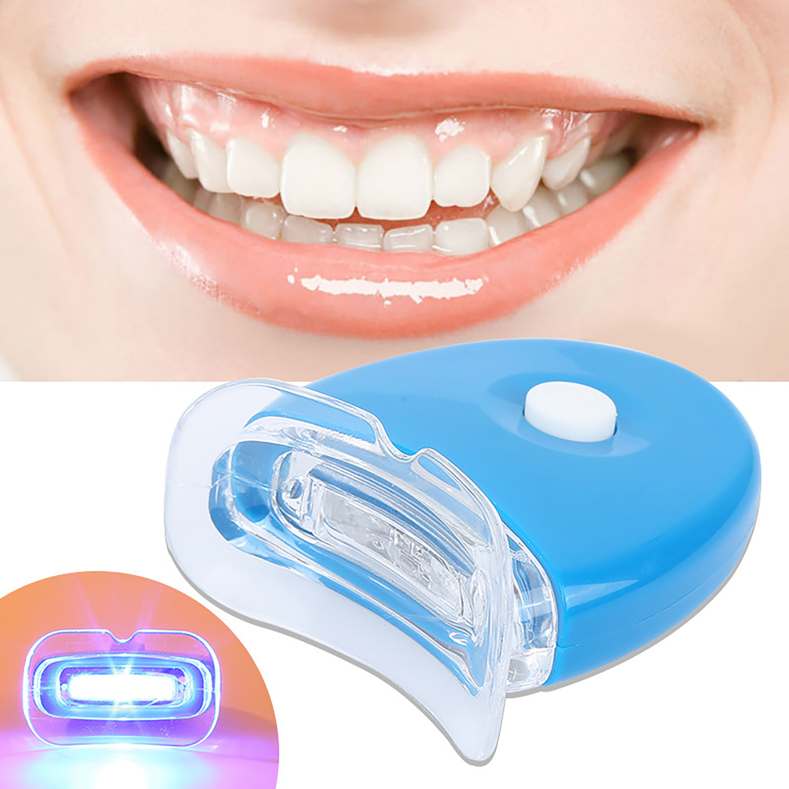 Teeth Whitening With Peroxide - Zahnaufhellung, Beschleuniger, Licht, Schönheit, Gesundheit, keine