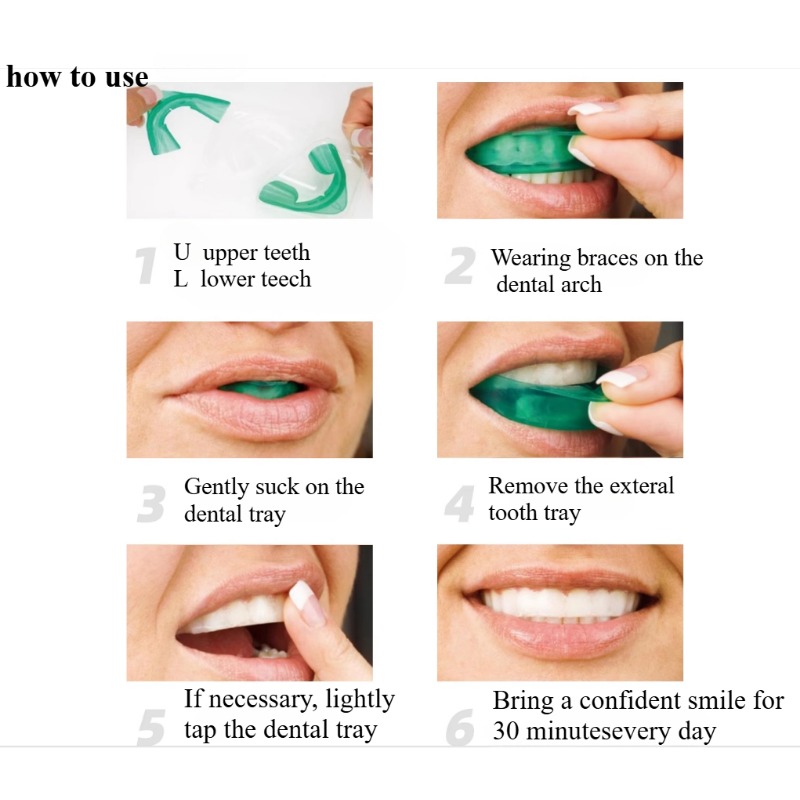 Set Zahnaufhellungstablett, U- – Teeth Whitening With Trays Bewertung und Preis