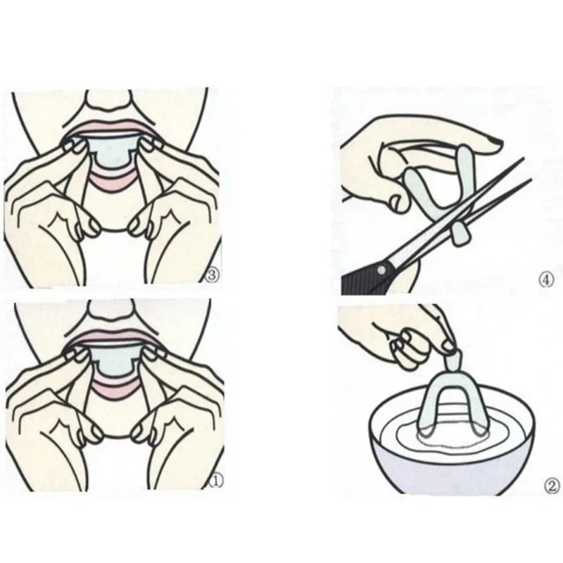 1/3/6 Paar Silikon-Mundschutz  – Teeth Whitening With Trays Bewertung und Preis