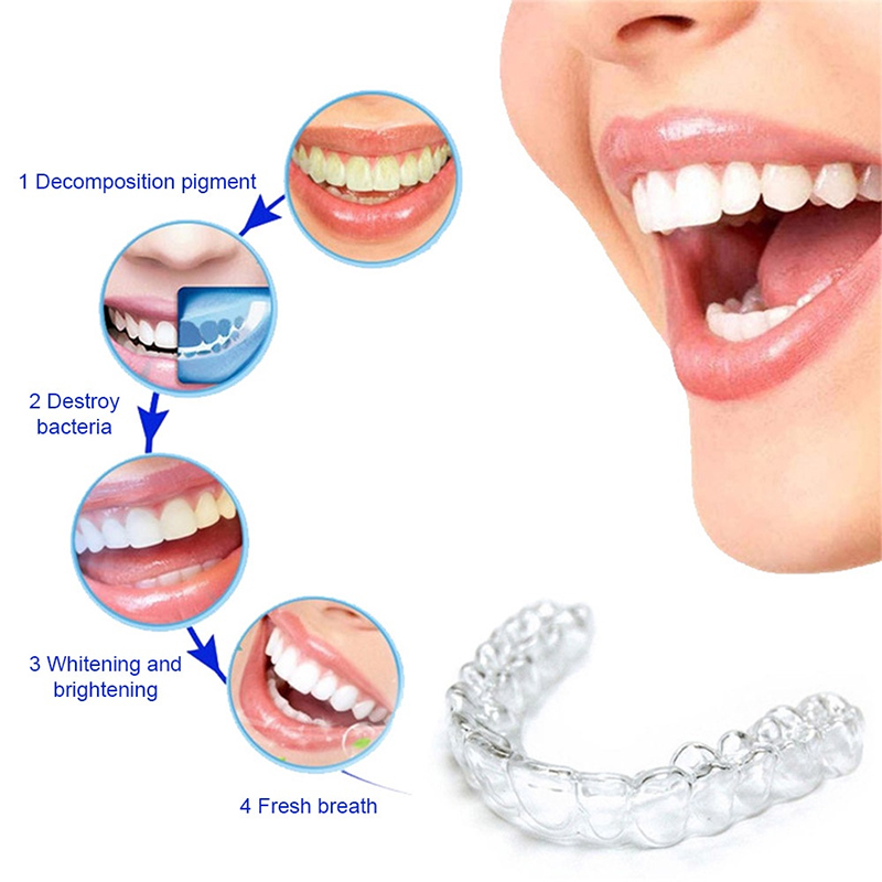Komfortabler Silikon-Mundschut – Teeth Whitening With Trays Bewertung und Preis