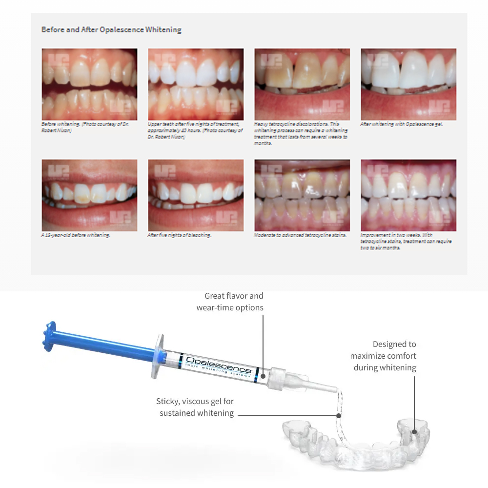 Opale scence White ning 1,2 pf – Teeth Whitening With Peroxide Bewertung und Preis