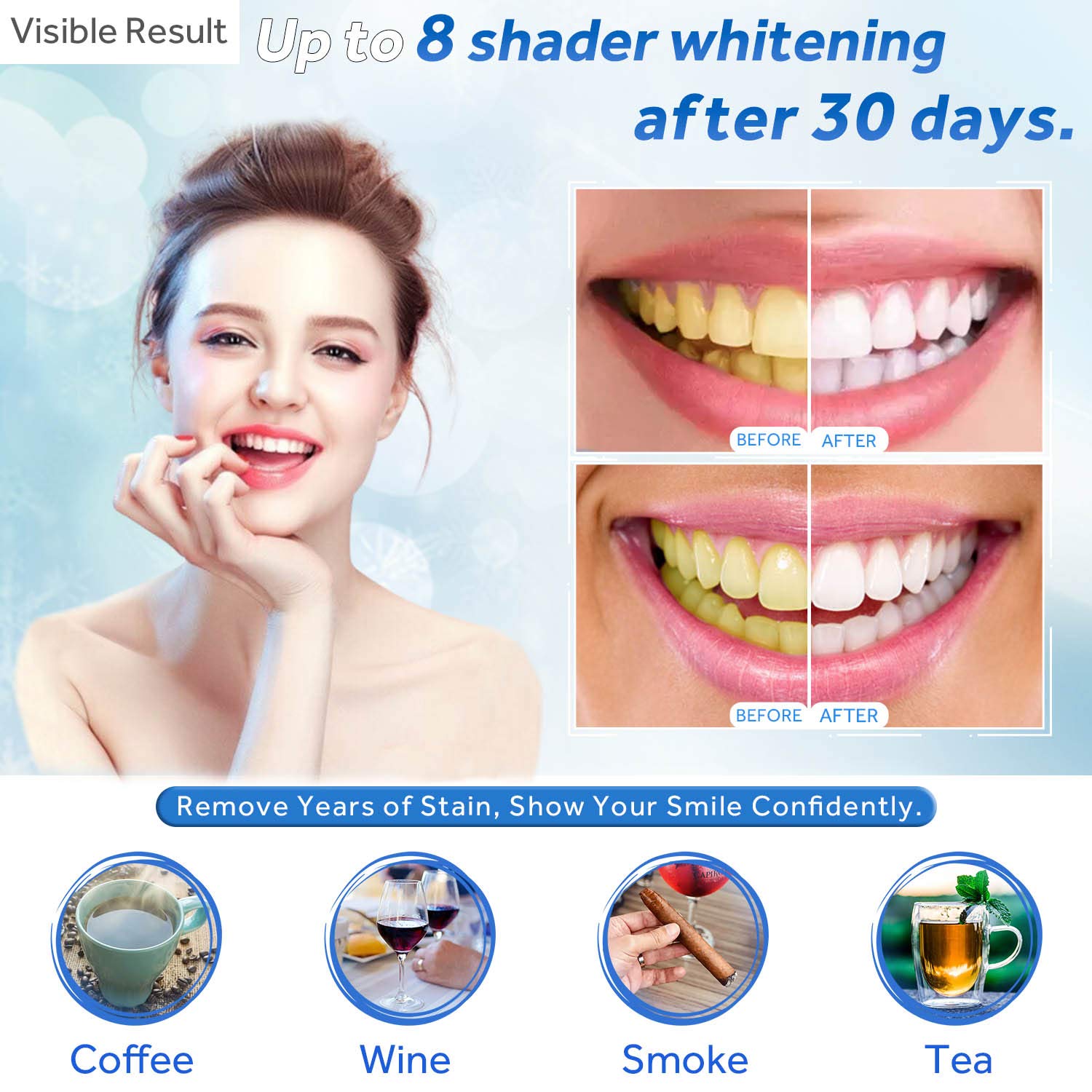 Zahnaufhellungsgel, Nachfüllsp – Teeth Whitening With Peroxide Bewertung und Preis