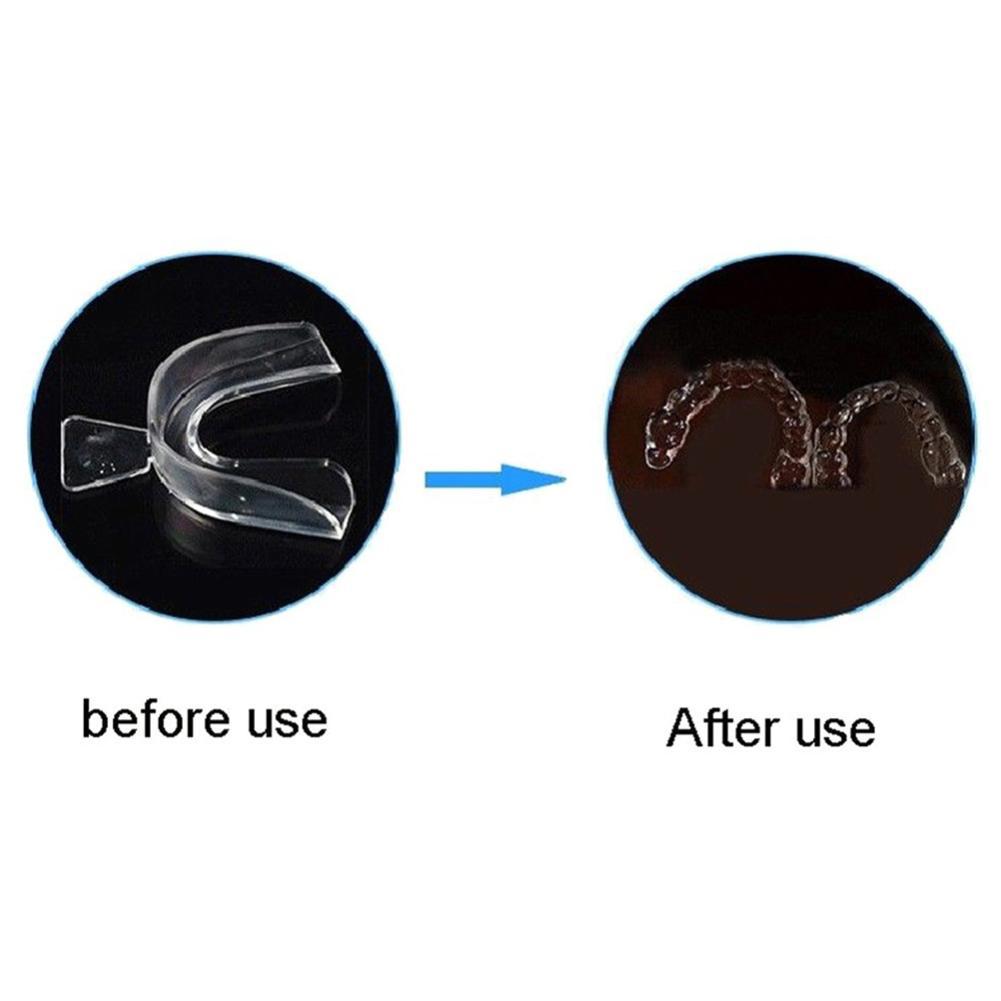 Silikon-Mundschutz für kiefero – Teeth Whitening With Trays Bewertung und Preis