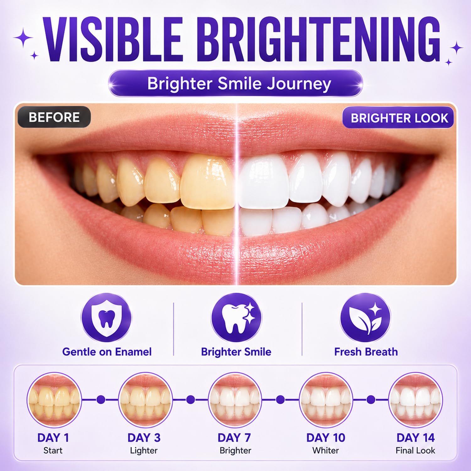 7/14/21 Stück Lila Zahnaufhell – Teeth Whitening With Peroxide Bewertung und Preis